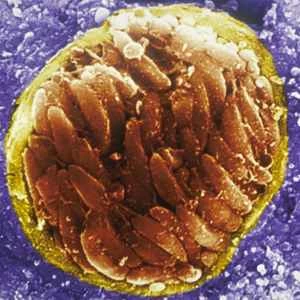 金ナノ粒子とレーザーが「猫狂い女」症候群を引き起こす脳寄生虫を駆除