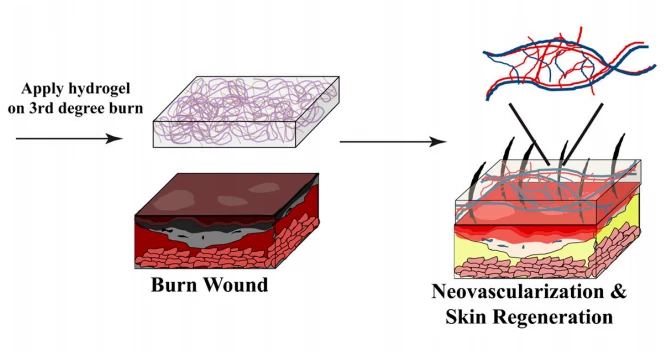 傷跡を治療するゼリーが、傷のない新鮮な肌を再生します