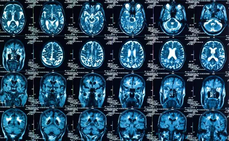 人工知能はがんの診断と治療においてますます重要な役割を果たしている