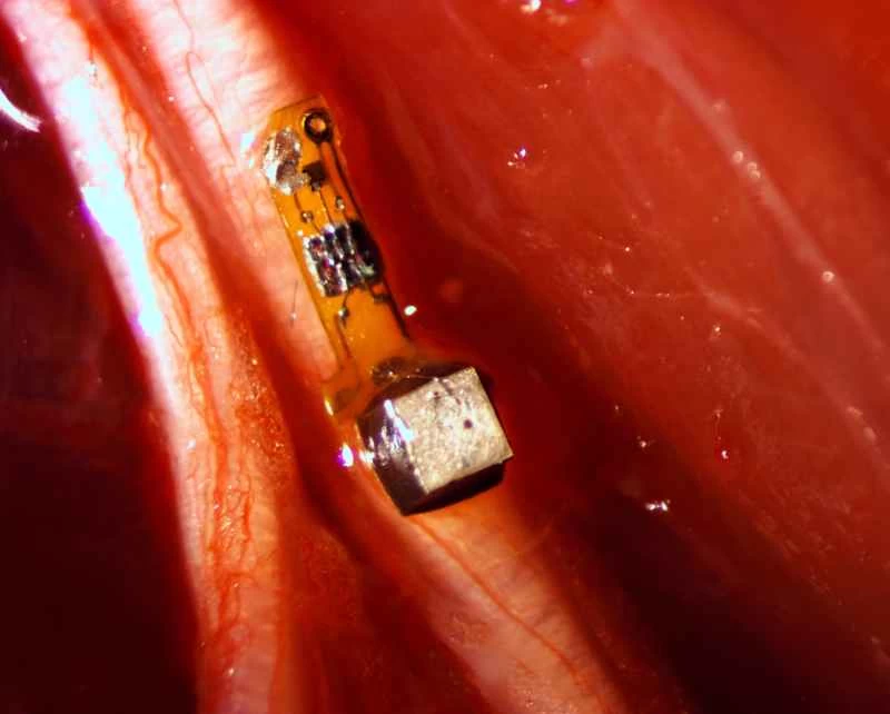 神経上の「ニューラルダスト」ボディセンサー