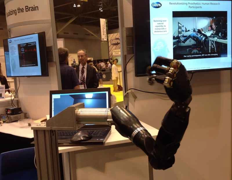 DARPA、脳に働きかけて患者にロボットタッチと記憶力向上を